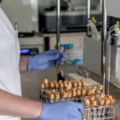 Laborantka w rękawiczkach bada próbkę, by sprawdzić, ferrytyna co to. W tle stojaki z probówkami.