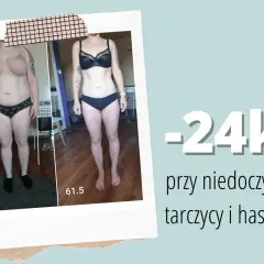 Metamorfoza: -24kg przy niedoczynności tarczycy i hashimoto. Dowiedz się, co jeść przy niedoczynności tarczycy aby schudnąć.