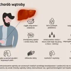 Ilustracja przedstawia objawy chorób wątroby, takie jak zmęczenie, ból, swędzenie skóry, nudności, żółtaczka. Zapalenie wątroby może objawiać się na wiele sposobów.