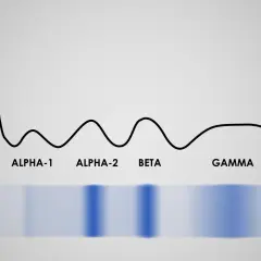 Wykres elektroforezy białek: albuminy, alfa-1, alfa-2, beta, gamma. To badanie proteinogram, które analizuje skład białek we krwi.