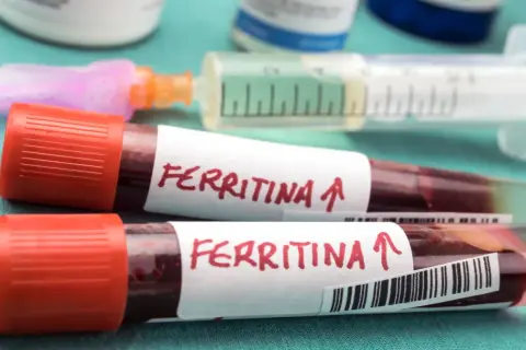 Dwie probówki z krwią oznaczone "Ferritina" i strzałką w górę, sugerujące potrzebę podniesienia poziomu ferrytyny. W tle strzykawka i inne materiały medyczne.