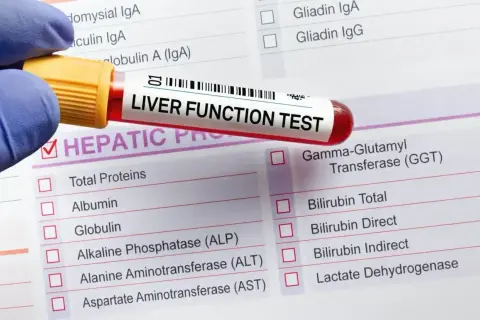 Próbówka z krwią do badania "LIVER FUNCTION TEST" leży na formularzu z listą parametrów, w tym ALT, AST, GGT. Wyniki mogą być podwyższone.