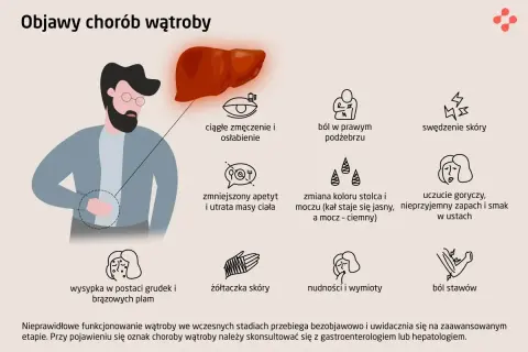 Ilustracja przedstawia objawy chorób wątroby, takie jak zmęczenie, ból, swędzenie skóry, nudności, żółtaczka. Zapalenie wątroby może objawiać się na wiele sposobów.