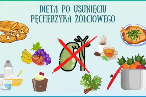Dieta po usunięciu woreczka żółciowego: unikać pieczywa, kawy, słodyczy. Zalecane owoce, warzywa, nabiał.