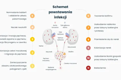 Schemat powstawania infekcji, prowadzącej do nawracającego zapalenia pęcherza. Ukazuje drogę bakterii od jelit do nerek.