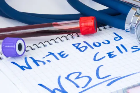 Wyniki badań krwi, probówki i stetoskop. Na notatniku napisano "White Blood Cells WBC". Zastanawiasz się, jaki poziom leukocytów jest niebezpieczny?