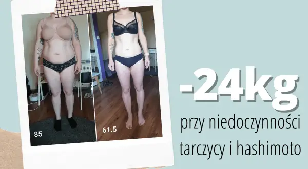 Metamorfoza: -24kg przy niedoczynności tarczycy i hashimoto. Dowiedz się, co jeść przy niedoczynności tarczycy aby schudnąć.