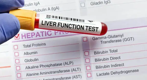 Próbówka z krwią do badania "LIVER FUNCTION TEST" leży na formularzu z listą parametrów, w tym ALT, AST, GGT. Wyniki mogą być podwyższone.