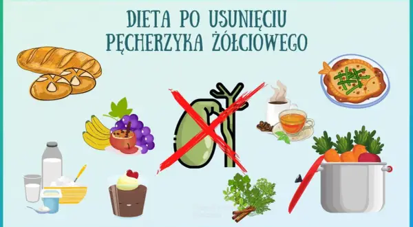 Dieta po usunięciu woreczka żółciowego: unikać pieczywa, kawy, słodyczy. Zalecane owoce, warzywa, nabiał.