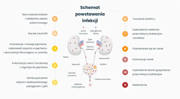 Schemat powstawania infekcji, prowadzącej do nawracającego zapalenia pęcherza. Ukazuje drogę bakterii od jelit do nerek.