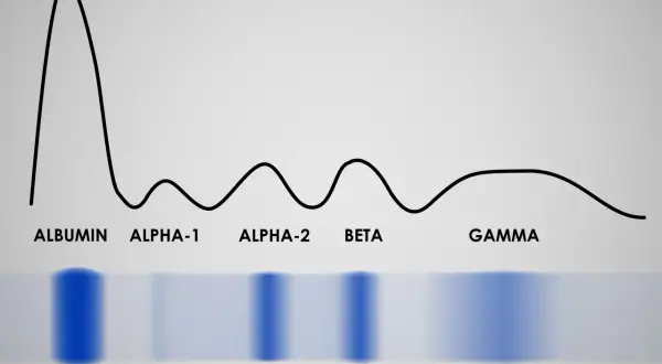 Wykres elektroforezy białek: albuminy, alfa-1, alfa-2, beta, gamma. To badanie proteinogram, które analizuje skład białek we krwi.