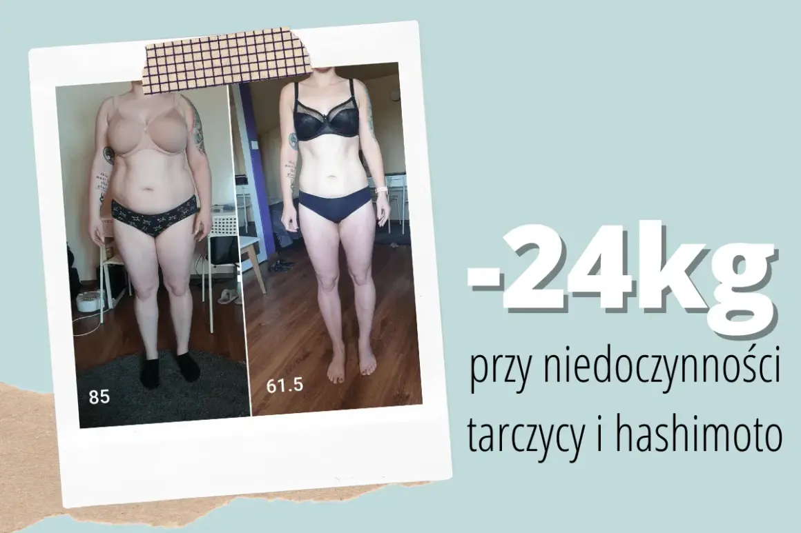 Metamorfoza: -24kg przy niedoczynności tarczycy i hashimoto. Dowiedz się, co jeść przy niedoczynności tarczycy aby schudnąć.