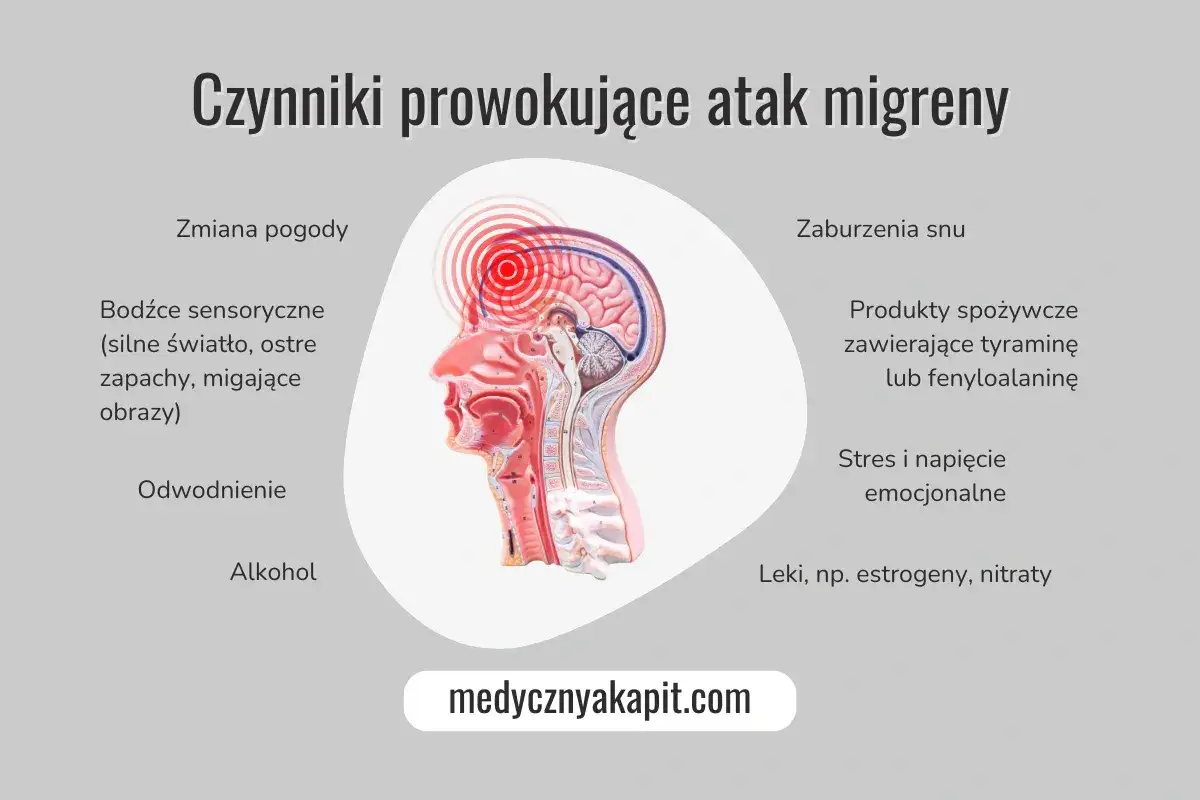 Migrena - jak rozpoznać napad i reagować od razu