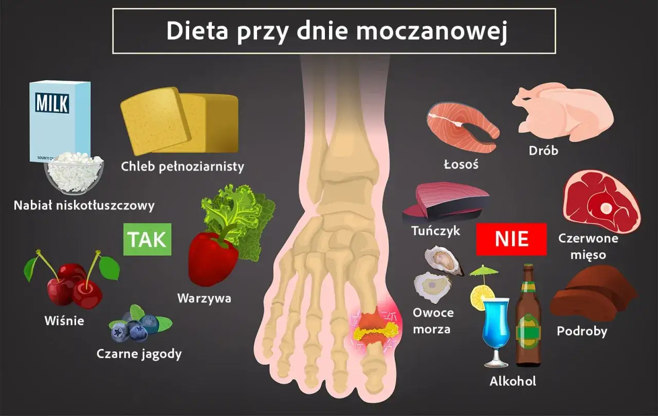 Dieta przy dnie moczanowej: nabiał, chleb pełnoziarnisty, warzywa, wiśnie, czarne jagody - TAK. Łosoś, drób - OK. Czerwone mięso, podroby, owoce morza, alkohol - NIE. Pomaga utrzymać kwas moczowy norma.