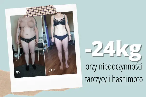 Metamorfoza: -24kg przy niedoczynności tarczycy i hashimoto. Dowiedz się, co jeść przy niedoczynności tarczycy aby schudnąć.