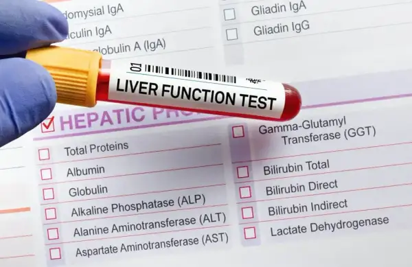 Próbówka z krwią do badania "LIVER FUNCTION TEST" leży na formularzu z listą parametrów, w tym ALT, AST, GGT. Wyniki mogą być podwyższone.