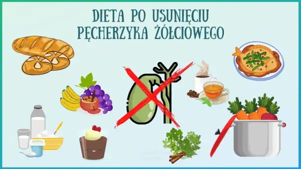 Dieta po usunięciu woreczka żółciowego: unikać pieczywa, kawy, słodyczy. Zalecane owoce, warzywa, nabiał.