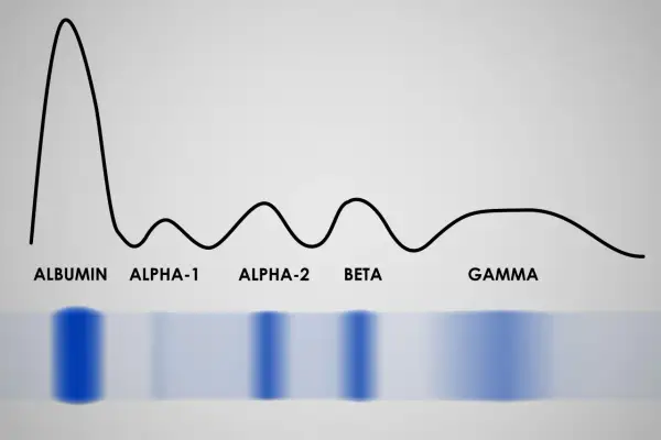 Wykres elektroforezy białek: albuminy, alfa-1, alfa-2, beta, gamma. To badanie proteinogram, które analizuje skład białek we krwi.